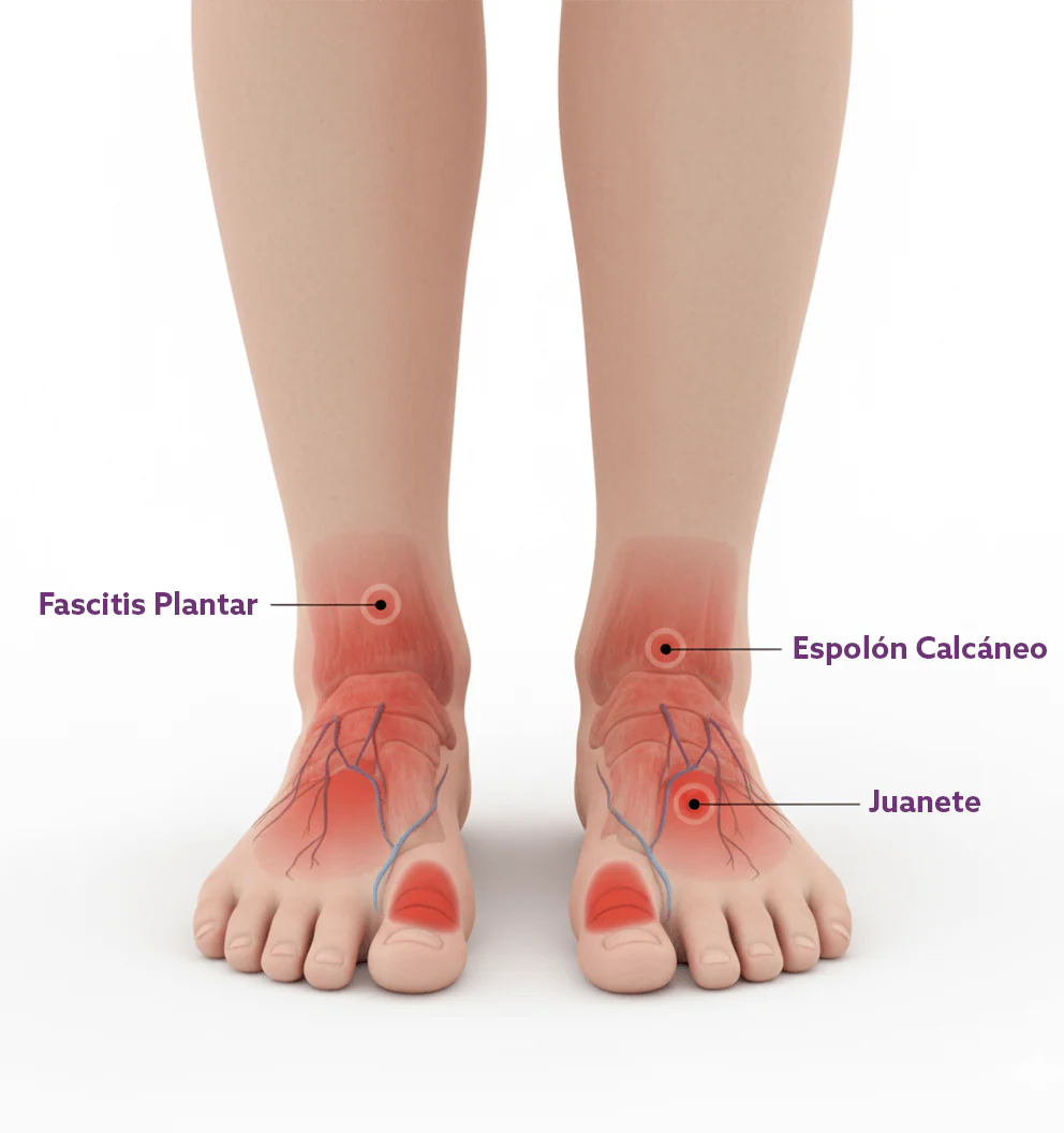 Los 5 problemas más comunes en los pies y cómo evitarlos