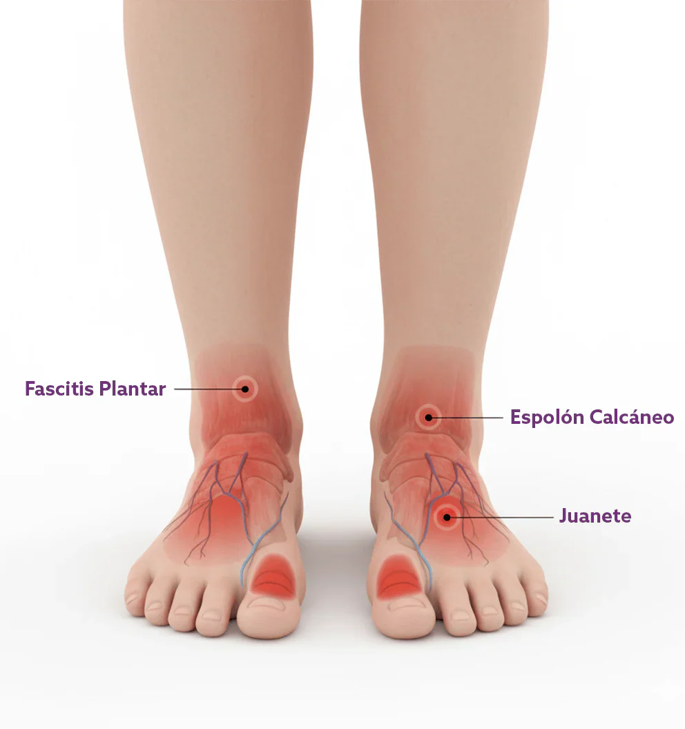 The 5 most common foot problems and how to avoid them